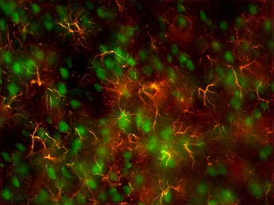 Sectional preparation of a rat brain showing neurons (green) and glial cells (red).